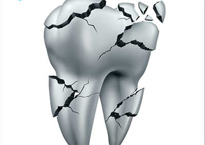 ¿Qué hacer cuando sufrimos traumatismo de un diente?